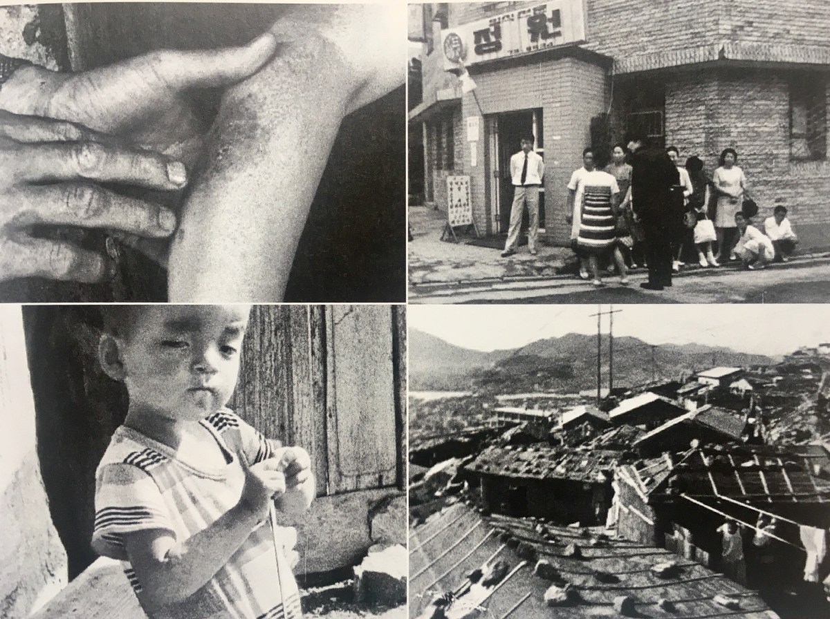 To the Japs: South Korean A-Bomb Survivors Speak Out (NDU,&nbsp;1971)